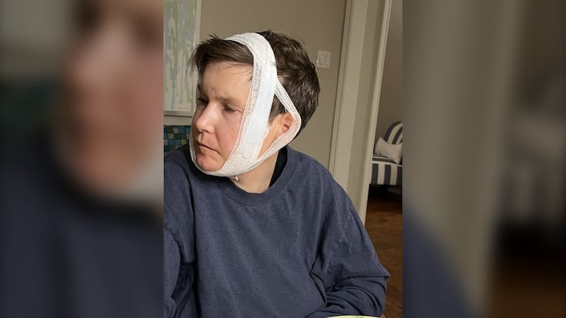 Mother says son was ‘savagely bitten’ at Toronto-area group home amid staff strike